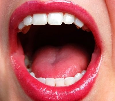 dry-mouth-remedy